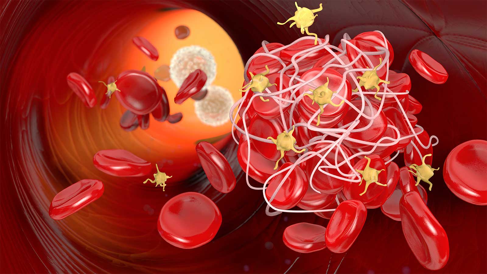 Outcome Prediction in Critically-Ill Patients with VTE and/or Cancer ...